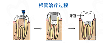 圖片8.png 圖片8.png